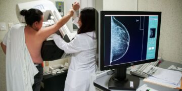 Aumentan casos de cáncer de mama en el estado