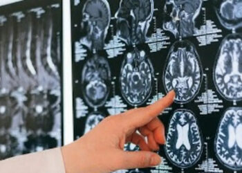 Descubren nueva membrana anatómica que protege al cerebro