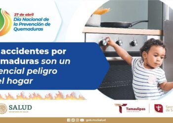 Refuerza Secretaría de Salud de Tamaulipas acciones de prevención de quemaduras
