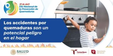 Refuerza Secretaría de Salud de Tamaulipas acciones de prevención de quemaduras
