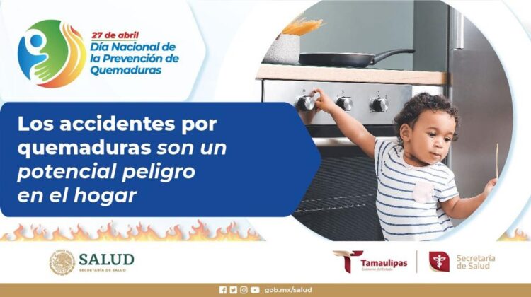 Refuerza Secretaría de Salud de Tamaulipas acciones de prevención de quemaduras