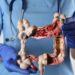 El alarmante aumento del cáncer en jóvenes menores de 50 años