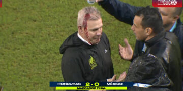 Pierde México ante Honduras 2-0, Aguirre sufre agresión con lata de cerveza