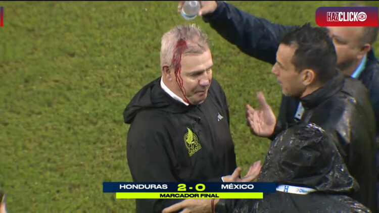 Pierde México ante Honduras 2-0, Aguirre sufre agresión con lata de cerveza