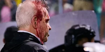 Concacaf anuncia veto a Honduras por la agresión a Javier aguirre
