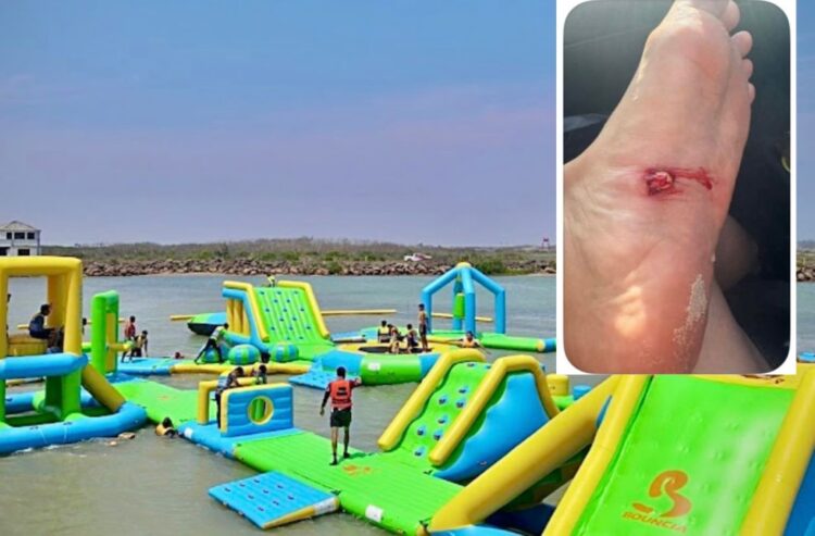 🚨Turista va de paseo y vive una pesadilla en La Pesca