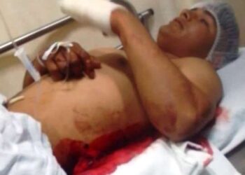 🚨 ¡Lo acuchillaron con un machete! Joven lucha por recuperarse tras brutal ataque